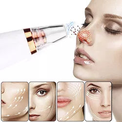 🧼✨ Succionador de Poros – Limpieza Profunda y Piel Libre de Imperfecciones